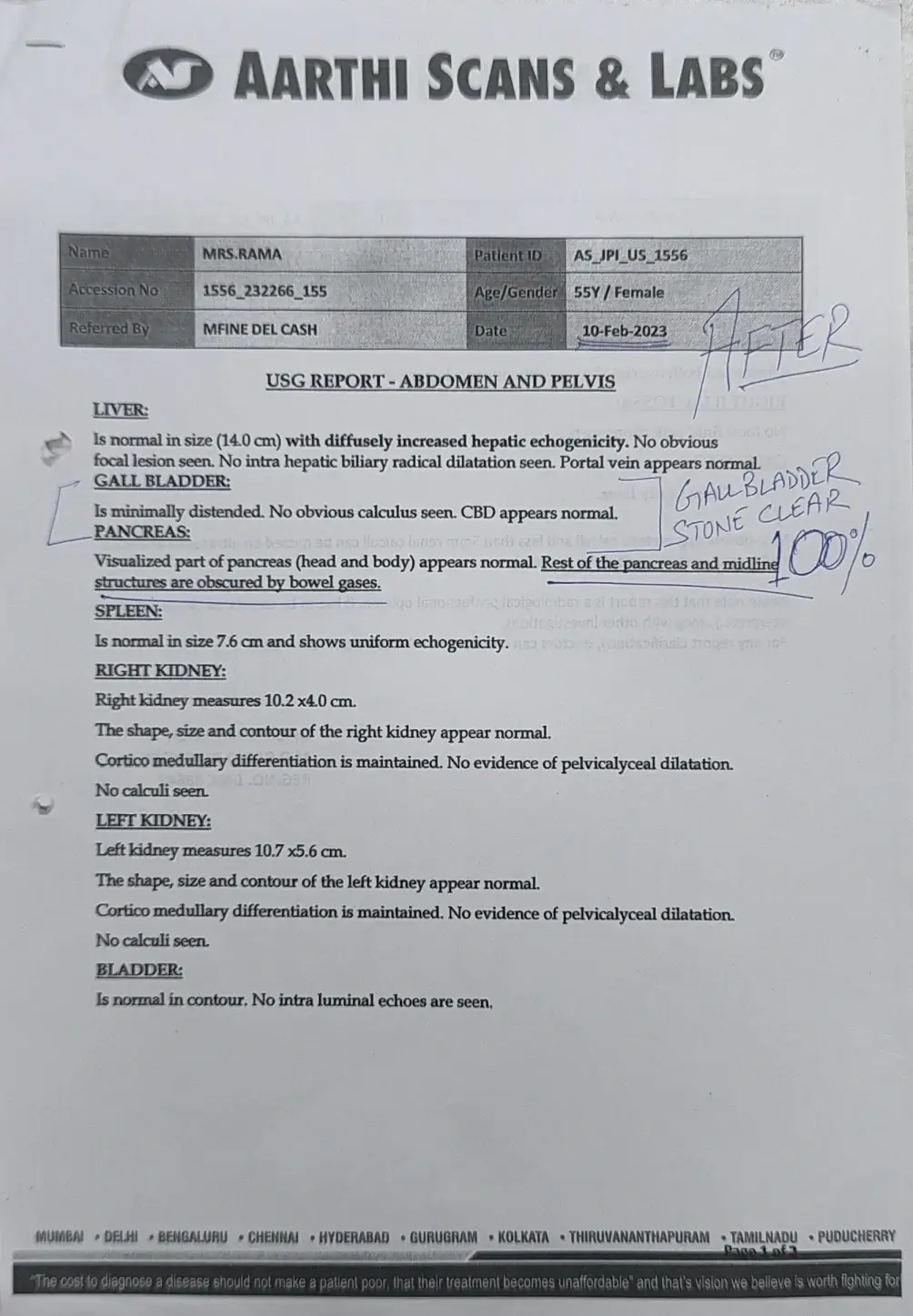 removed gallstones naturally without operation